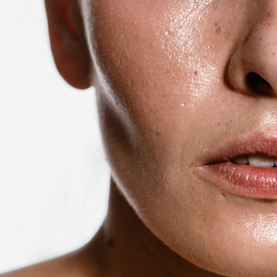 The Best Natural Skincare Routine for Oily Skin