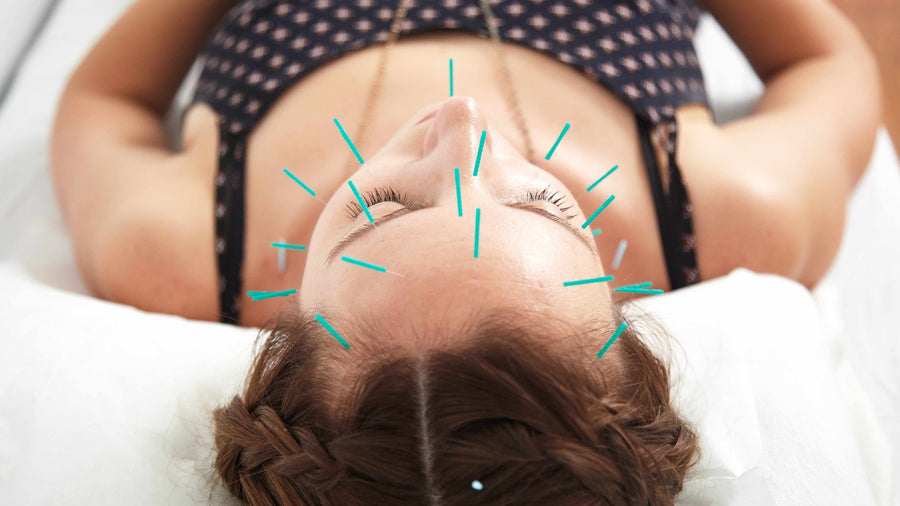 Facial Acupuncture: Benefits & What it Can Do For You
