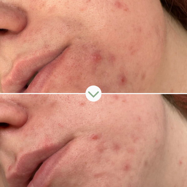 Pai Skincare-Phaze Rebalance Cleanser-Skincare-5060139729048_5-The Detox Market | 