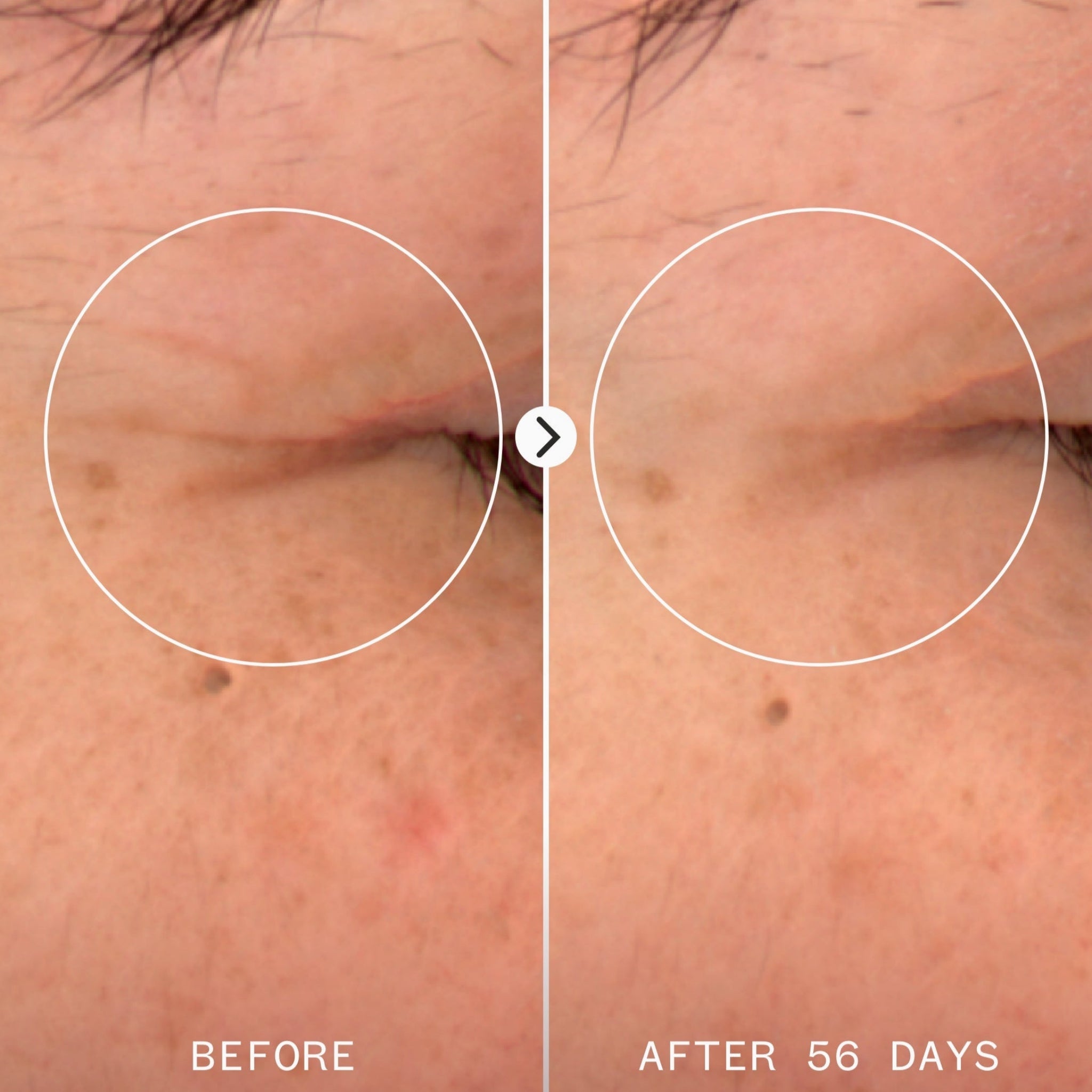 Pai Skincare-Age Confidence Nad & Tri Peptide Renewal Serum-Skincare-5060139729826_1920x2496_BEFORE_AFTER-The Detox Market | 