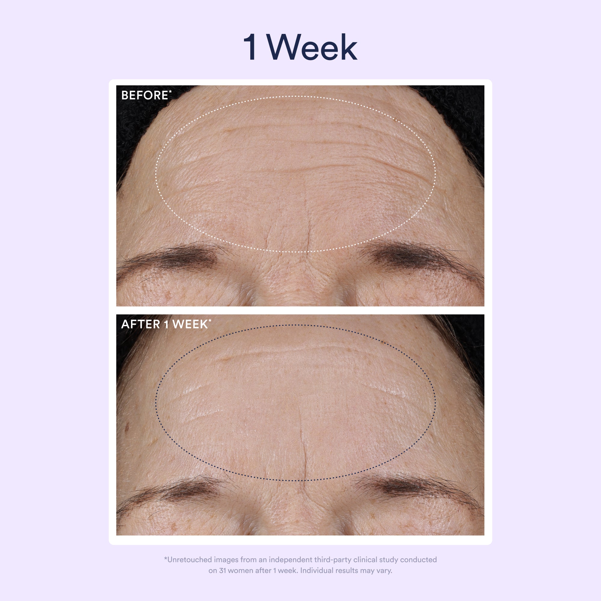 OSEA-Dream Night Serum With Bio-Retinol-Skincare-675468103466_04-The Detox Market | 