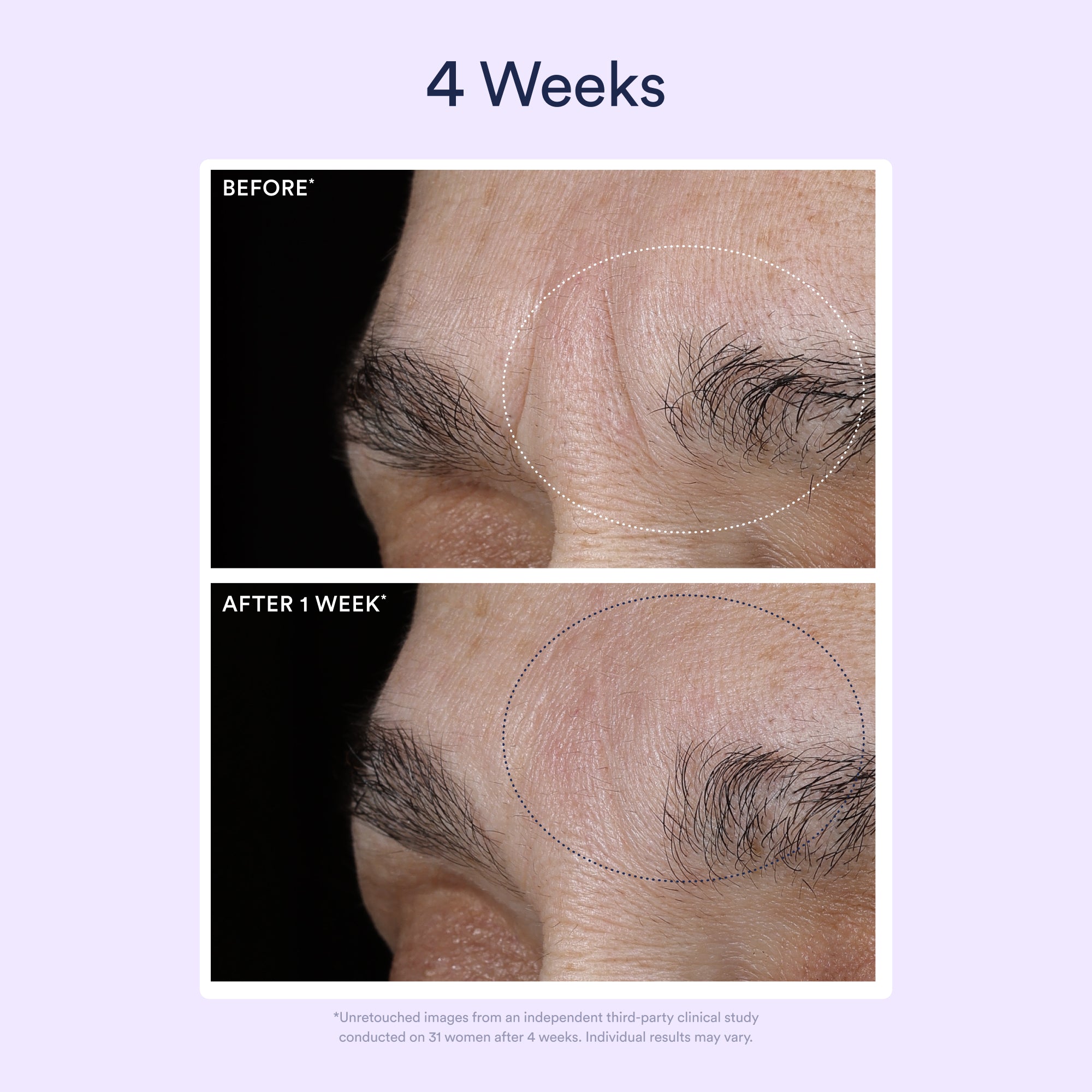 OSEA-Dream Night Serum With Bio-Retinol-Skincare-675468103466_05-The Detox Market | 