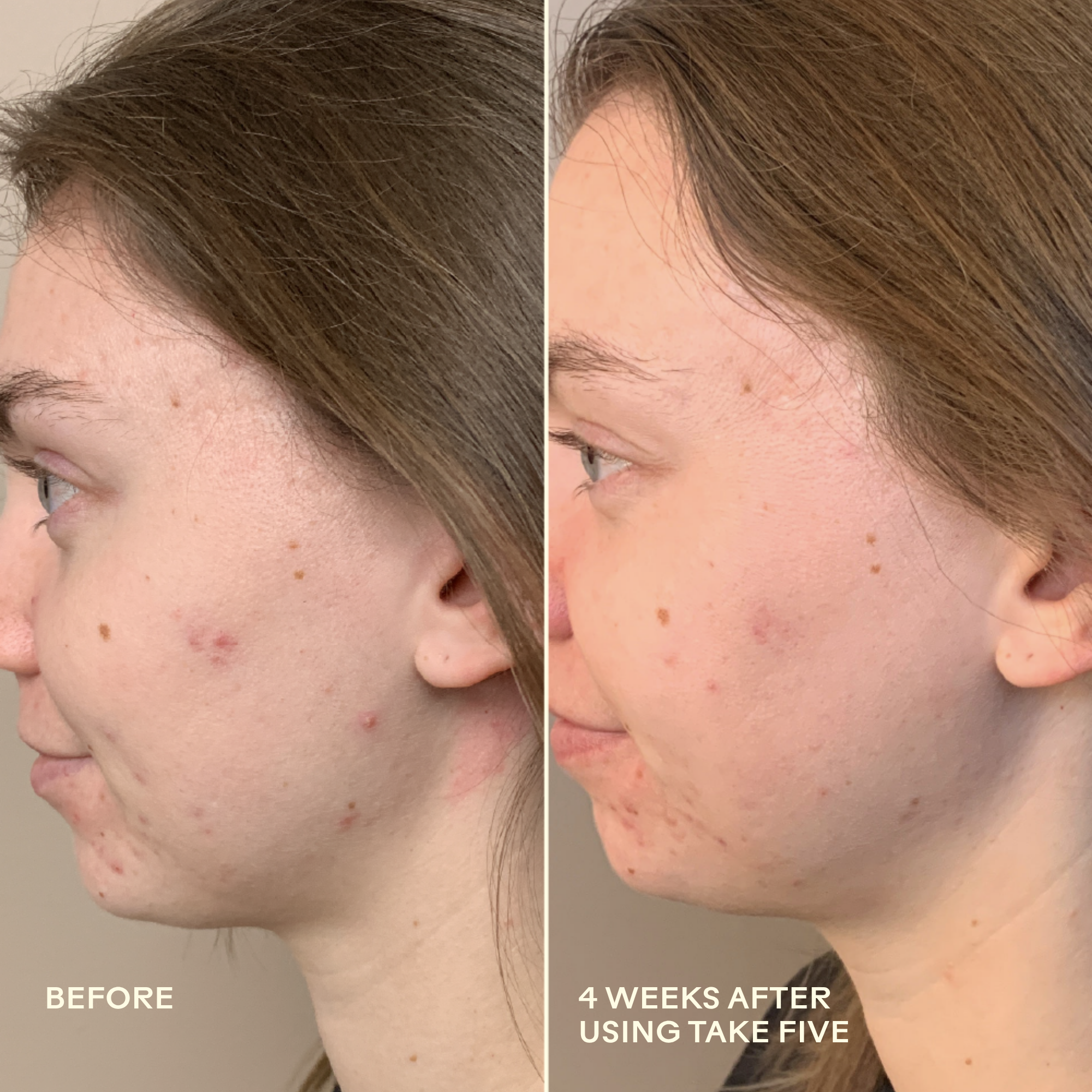 Three Ships-Take Five™ Hypochlorous Acid Balancing Body + Face Spray-Skincare-990478500341_8_Before_After-The Detox Market | 