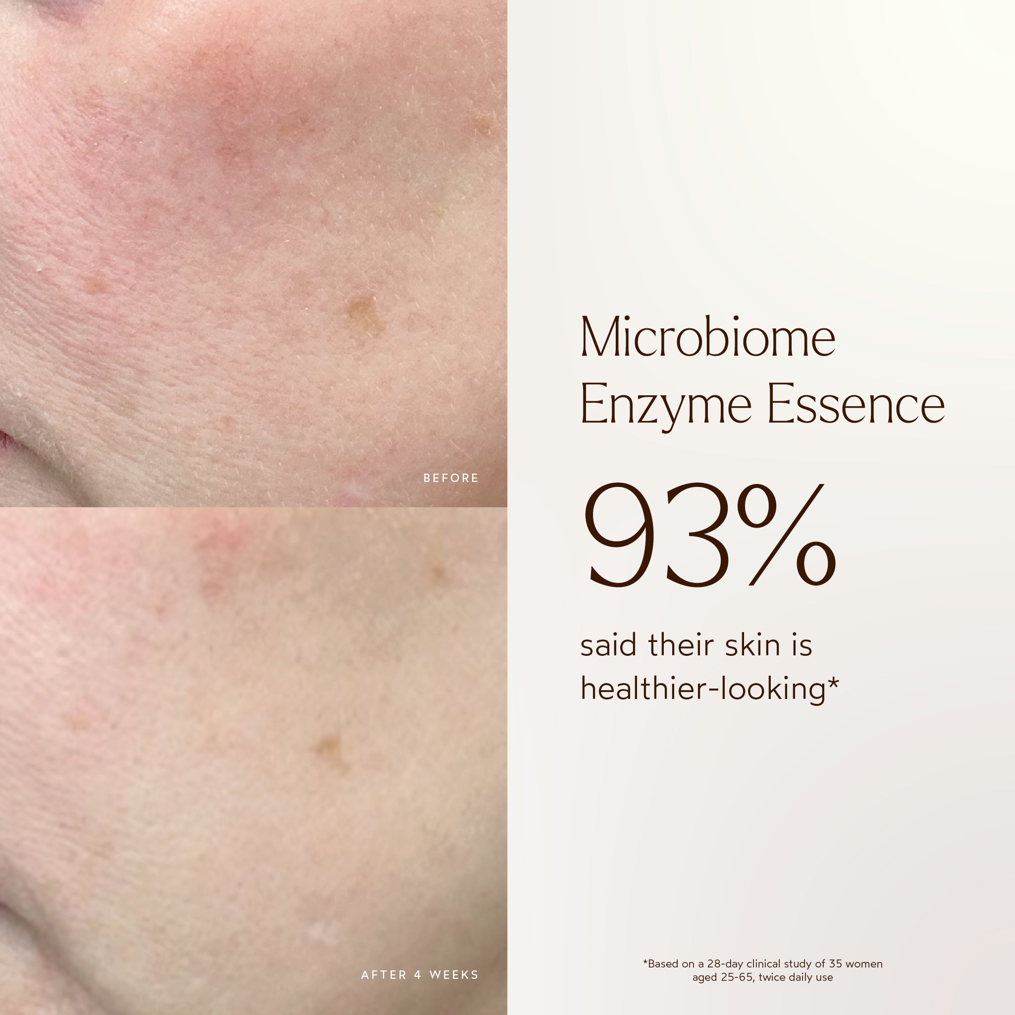 True Botanicals-Renew Microbiome Enzyme Essence-Skincare-BA1_Essence_2048x2048_0fbe18ff-a9bc-4b00-8a07-408f5ca8ba36-The Detox Market | 