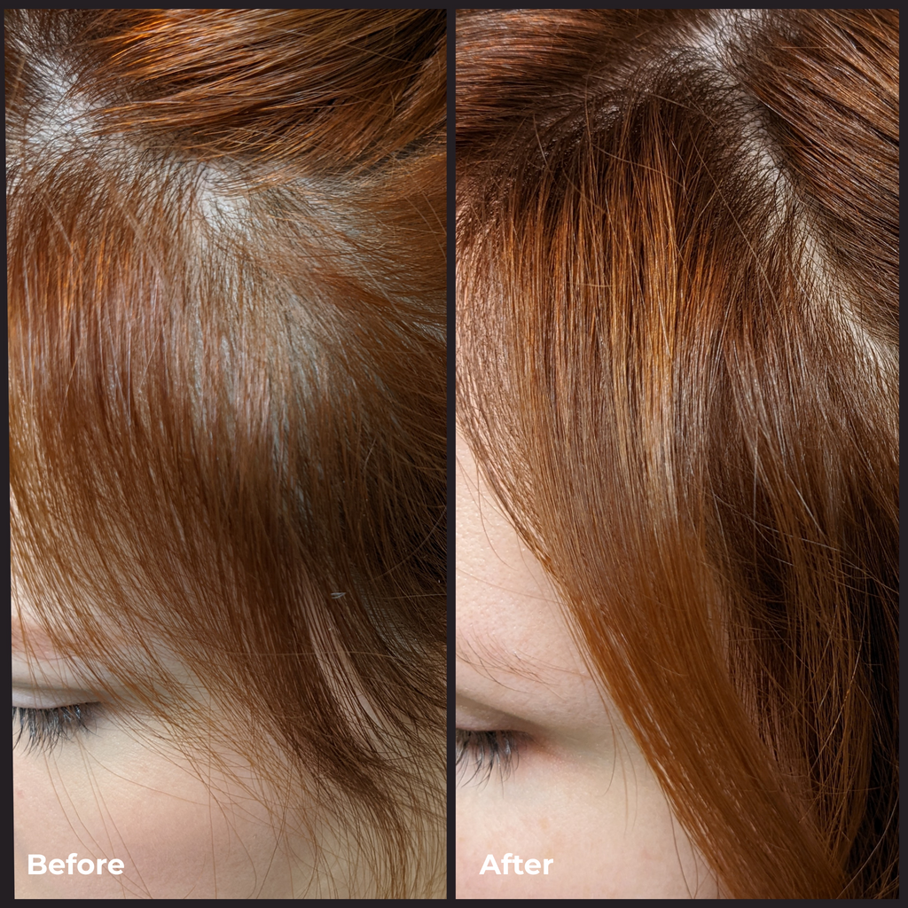 EVOLVh-Better Roots RootBoost Serum-