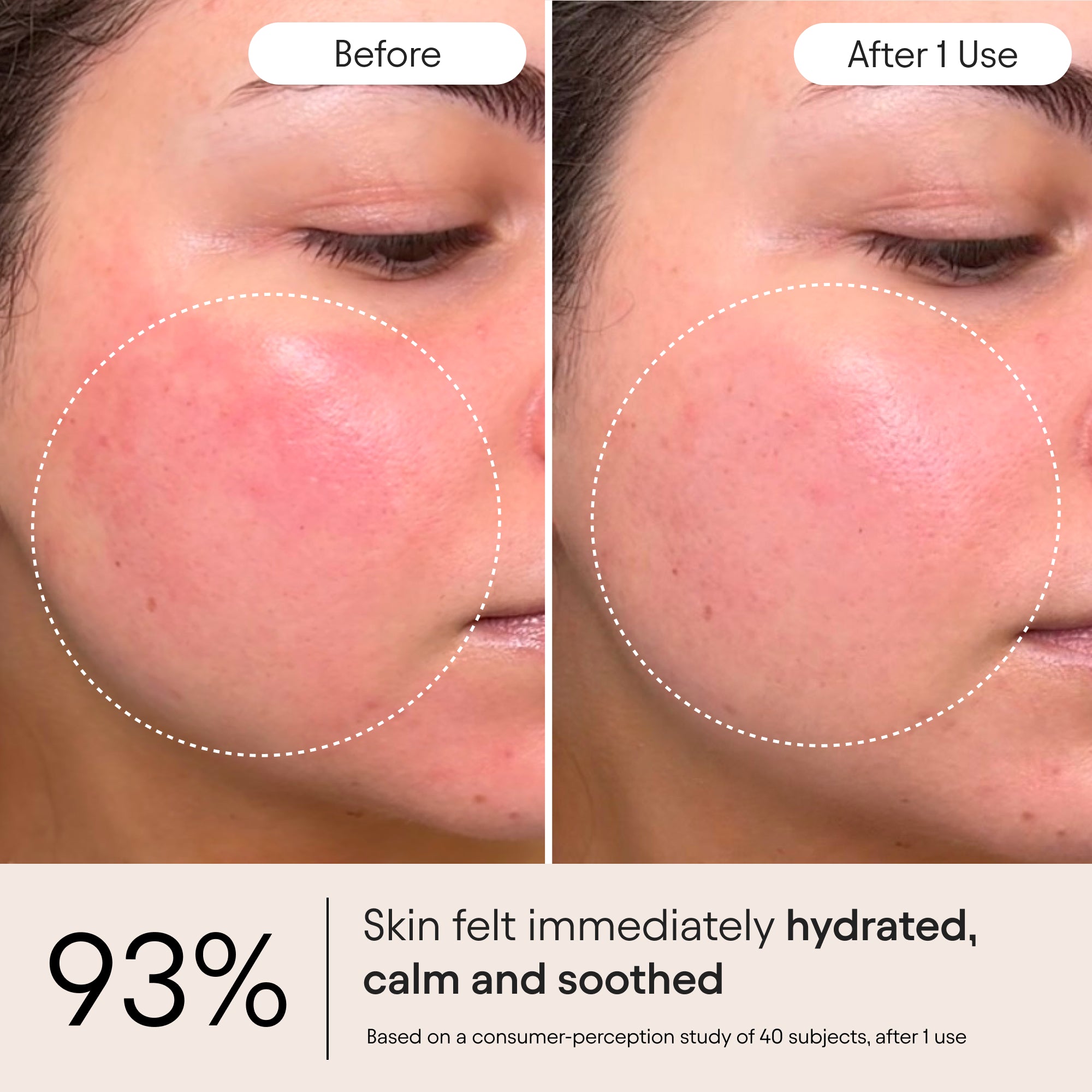 Alpyn Beauty-Barrier Repair Cream-Skincare-BarrierRepair4-The Detox Market | 