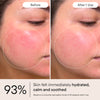 Alpyn Beauty-Barrier Repair Cream-Skincare-BarrierRepair4-The Detox Market | 