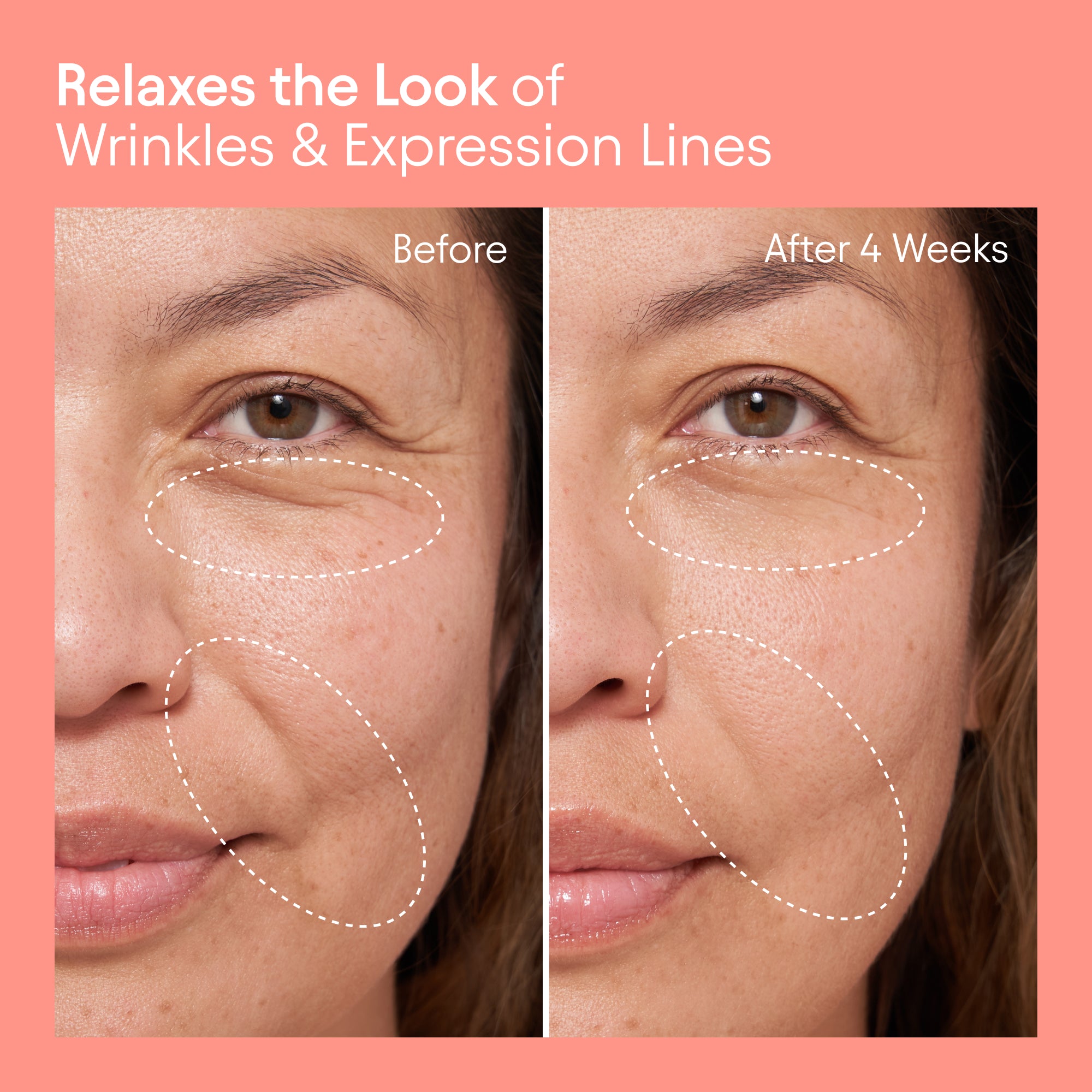 Alpyn Beauty-Barrier Repair Cream-Skincare-BarrierRepairCream_2-The Detox Market | 