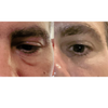 Maya Chia-The Advanced Eye Response Complex-Skincare-BeforeAfter1-The Detox Market | 