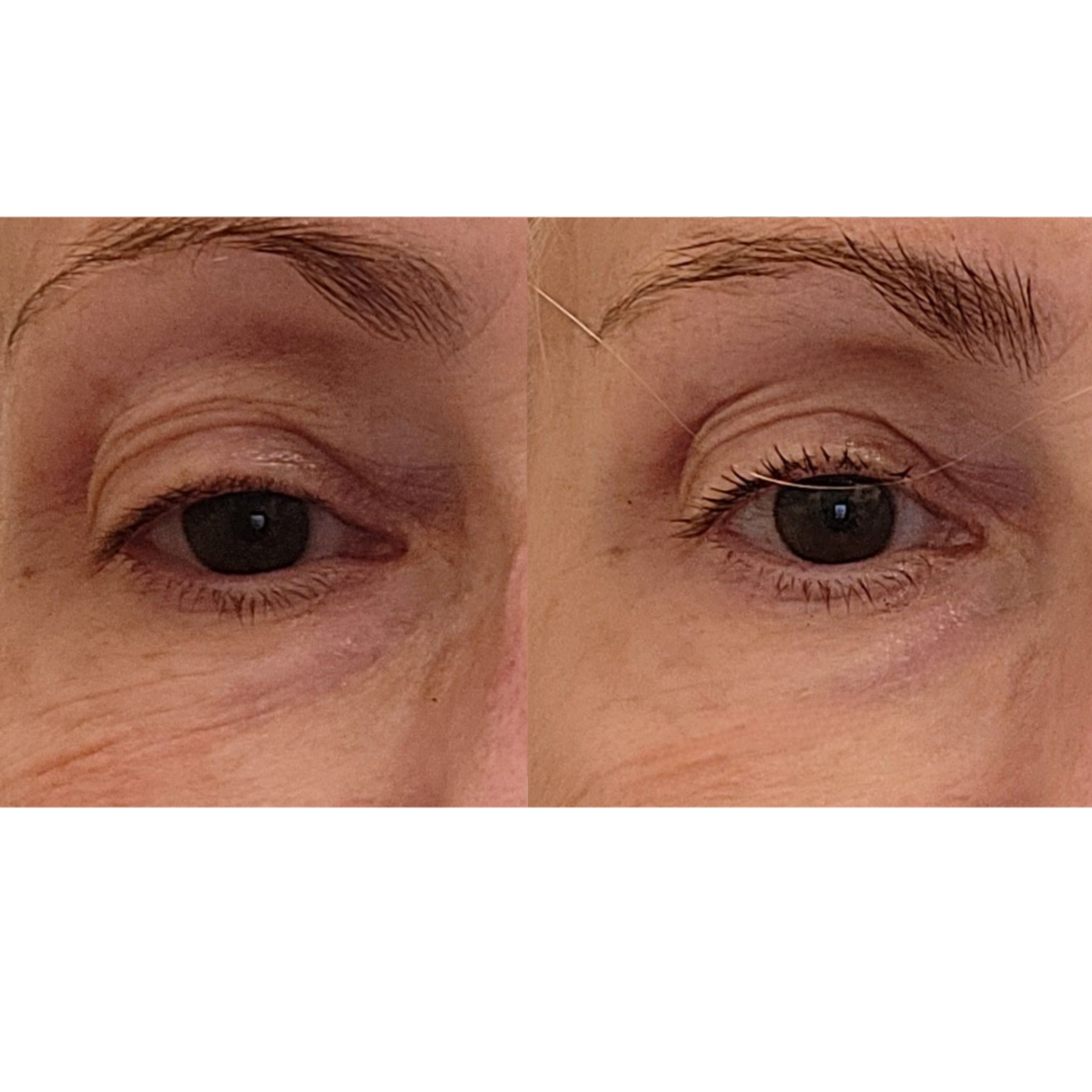 Maya Chia-The Advanced Eye Response Complex-Skincare-BeforeAfter3-The Detox Market | 