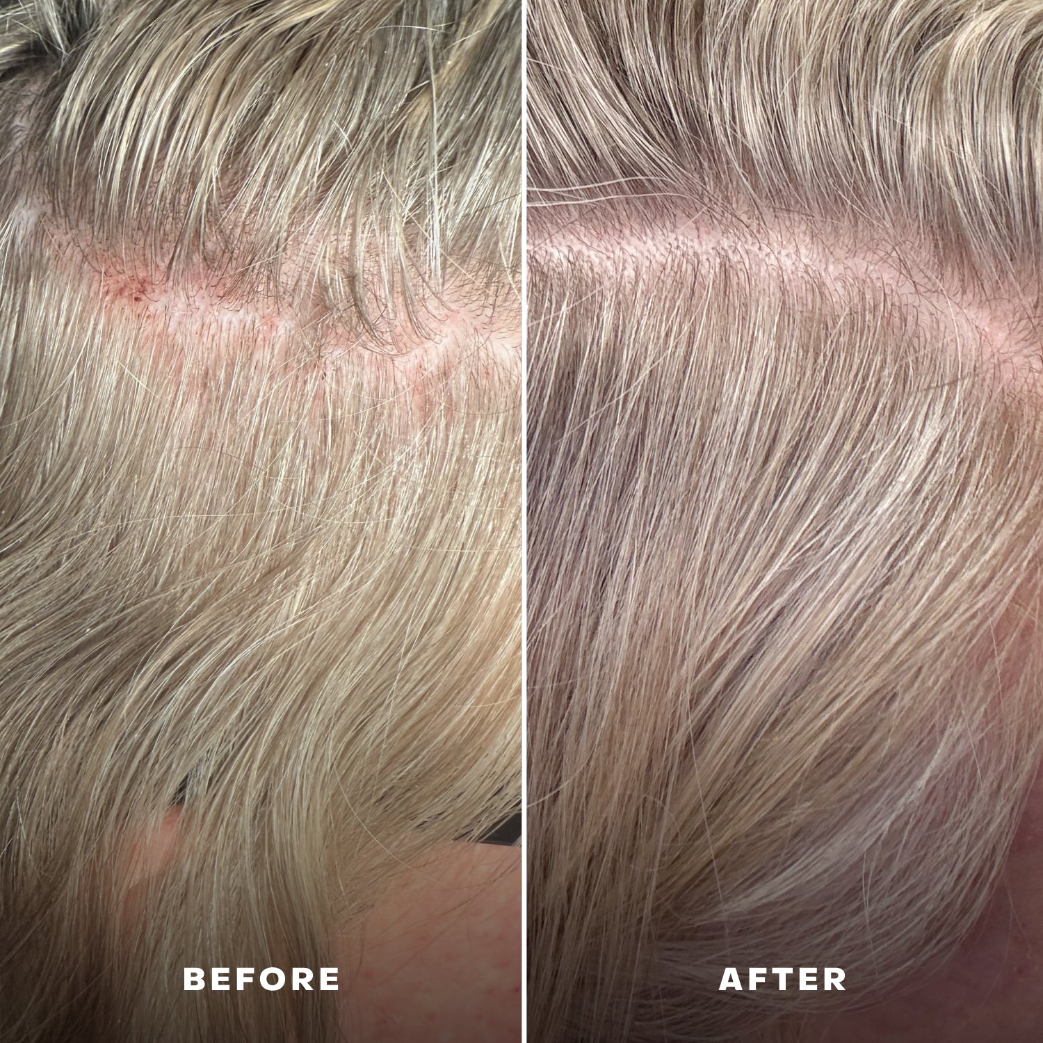 Everist-Everboost Multi-Peptide Scalp Serum-Hair-Everist_6-The Detox Market | 