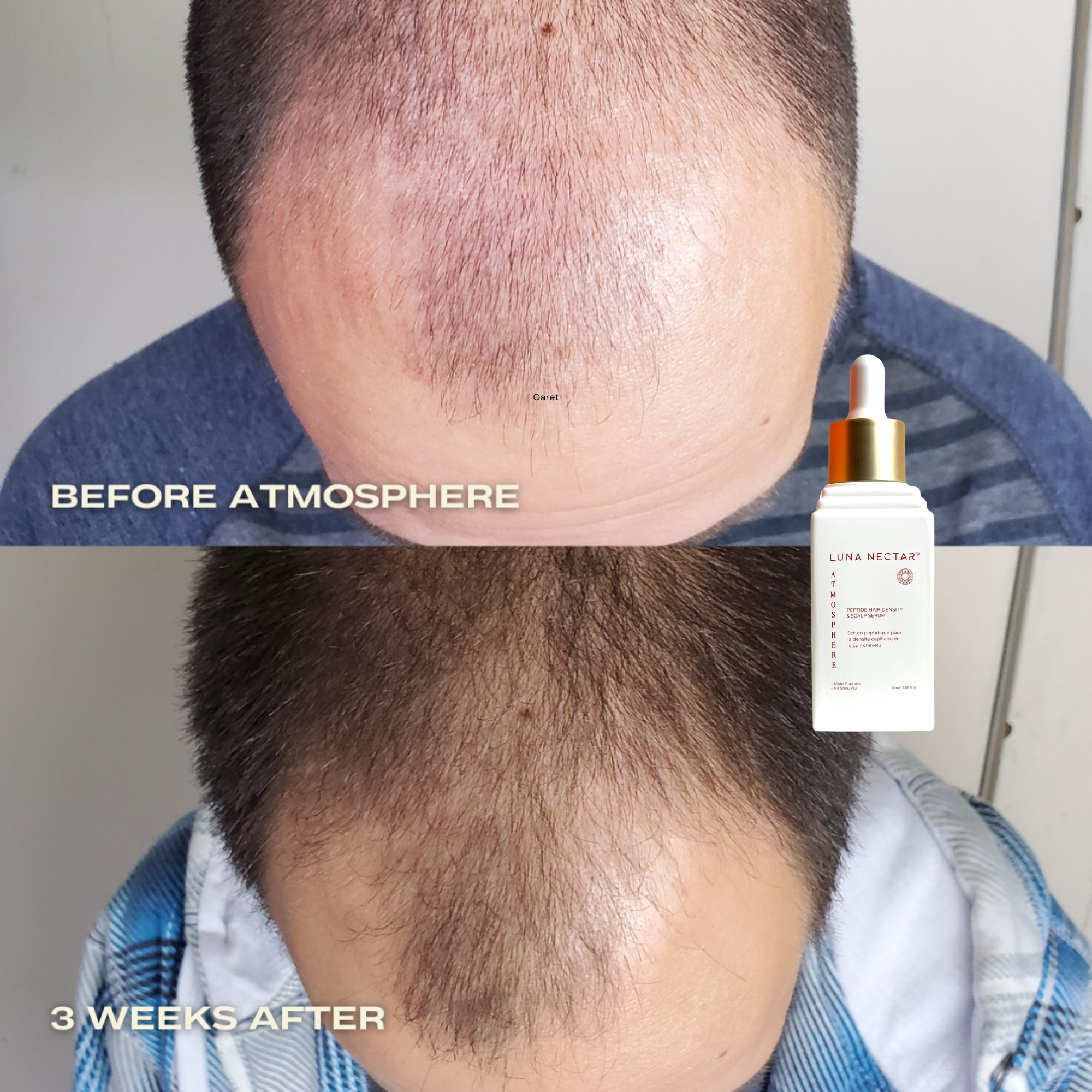 Luna Nectar-Atmosphere Hair Density & Scalp Serum-Hair-F.R007-The Detox Market | 