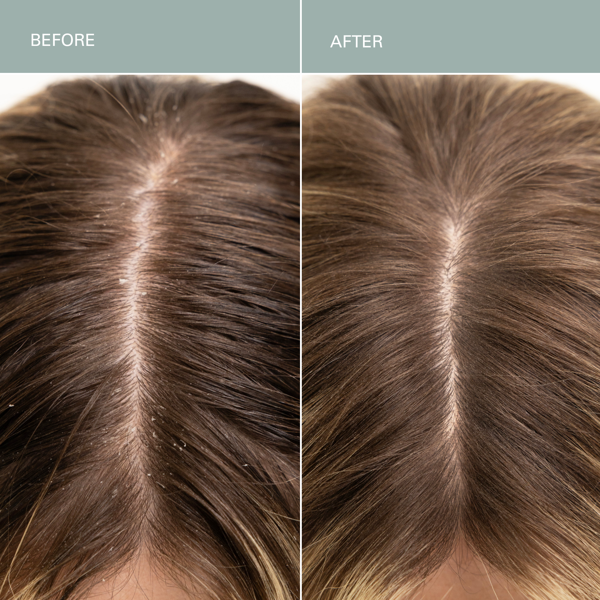 RŌZ-Salt Scalp Scrub Exfoliating Detox Shampoo-Hair-FGRZSCSCB0000_02_e3cdbb97-d71e-4340-af16-0f49e78fd9b9-The Detox Market | 