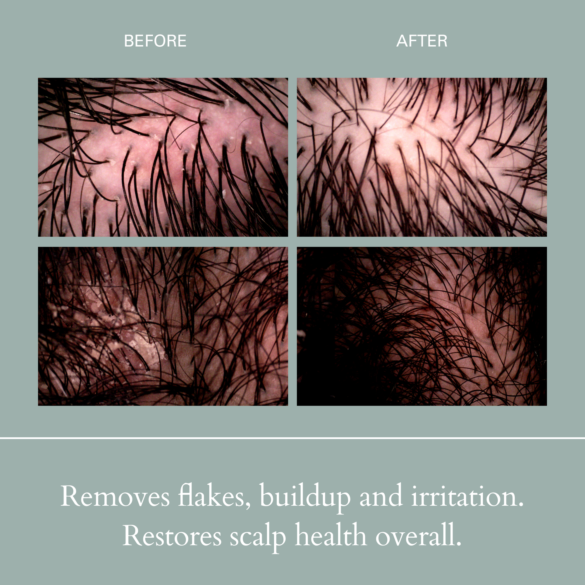 RŌZ-Salt Scalp Scrub Exfoliating Detox Shampoo-Hair-FGRZSCSCB0000_04_48db191b-a762-408e-ad21-34f26647bf58-The Detox Market | 