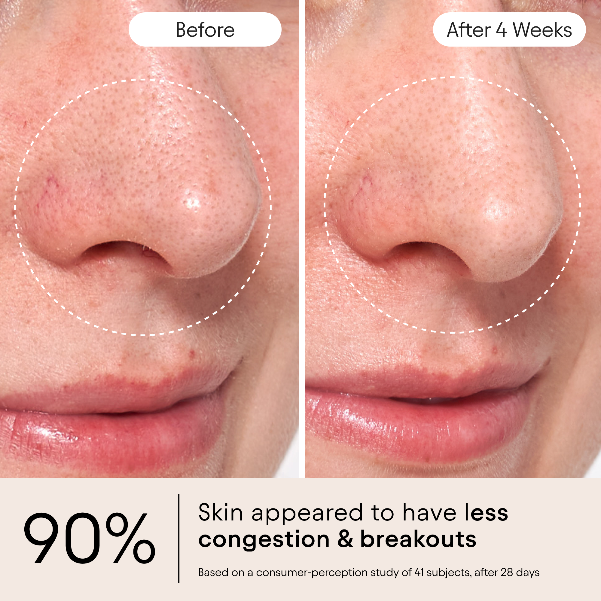 Alpyn Beauty-Clarifying Facial Oil With Retinol & Pink Algae-Skincare-FaceOil4_bbacb191-120a-412d-9d38-53d32db75e6b-The Detox Market | 