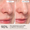Alpyn Beauty-Clarifying Facial Oil With Retinol & Pink Algae-Skincare-FaceOil4_bbacb191-120a-412d-9d38-53d32db75e6b-The Detox Market | 