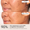 Alpyn Beauty-Clarifying Facial Oil With Retinol & Pink Algae-Skincare-FaceOil5-The Detox Market | 