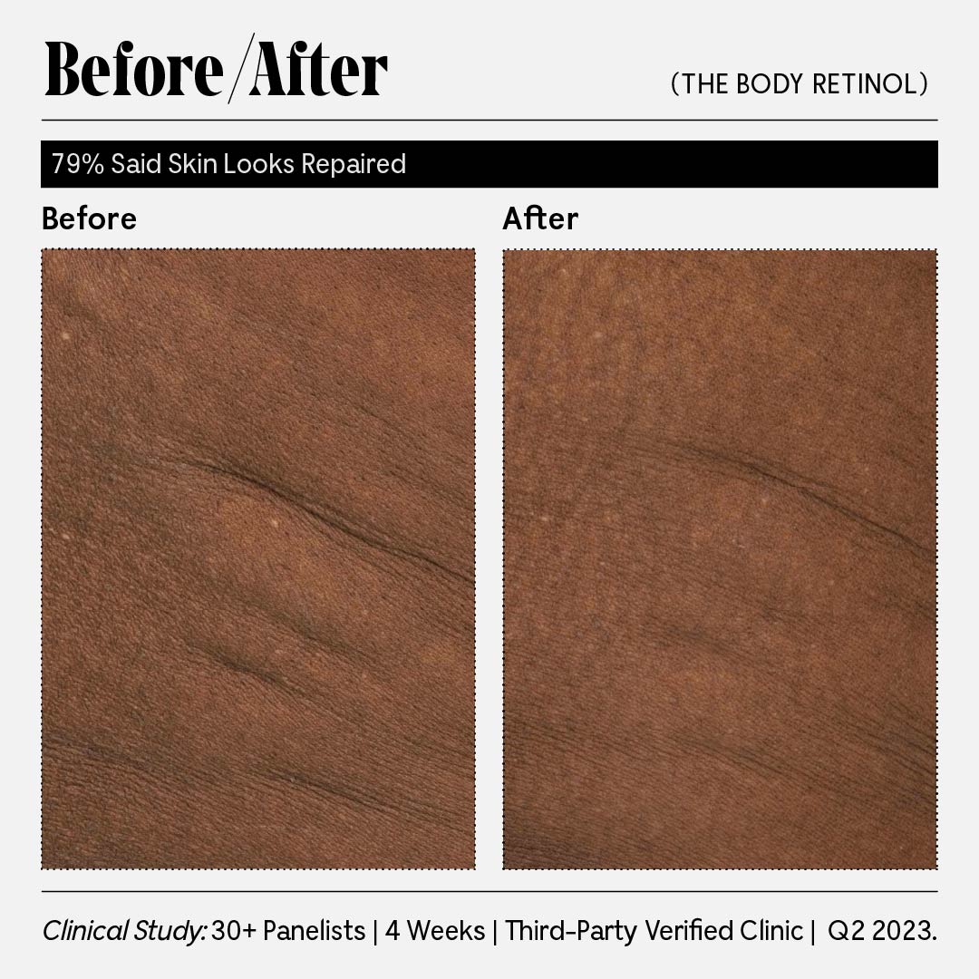 Nécessaire-The Body Retinol-Body-N_cessaire_RetailerGraphics_2023_TheBodyRetinol_14-The Detox Market | 