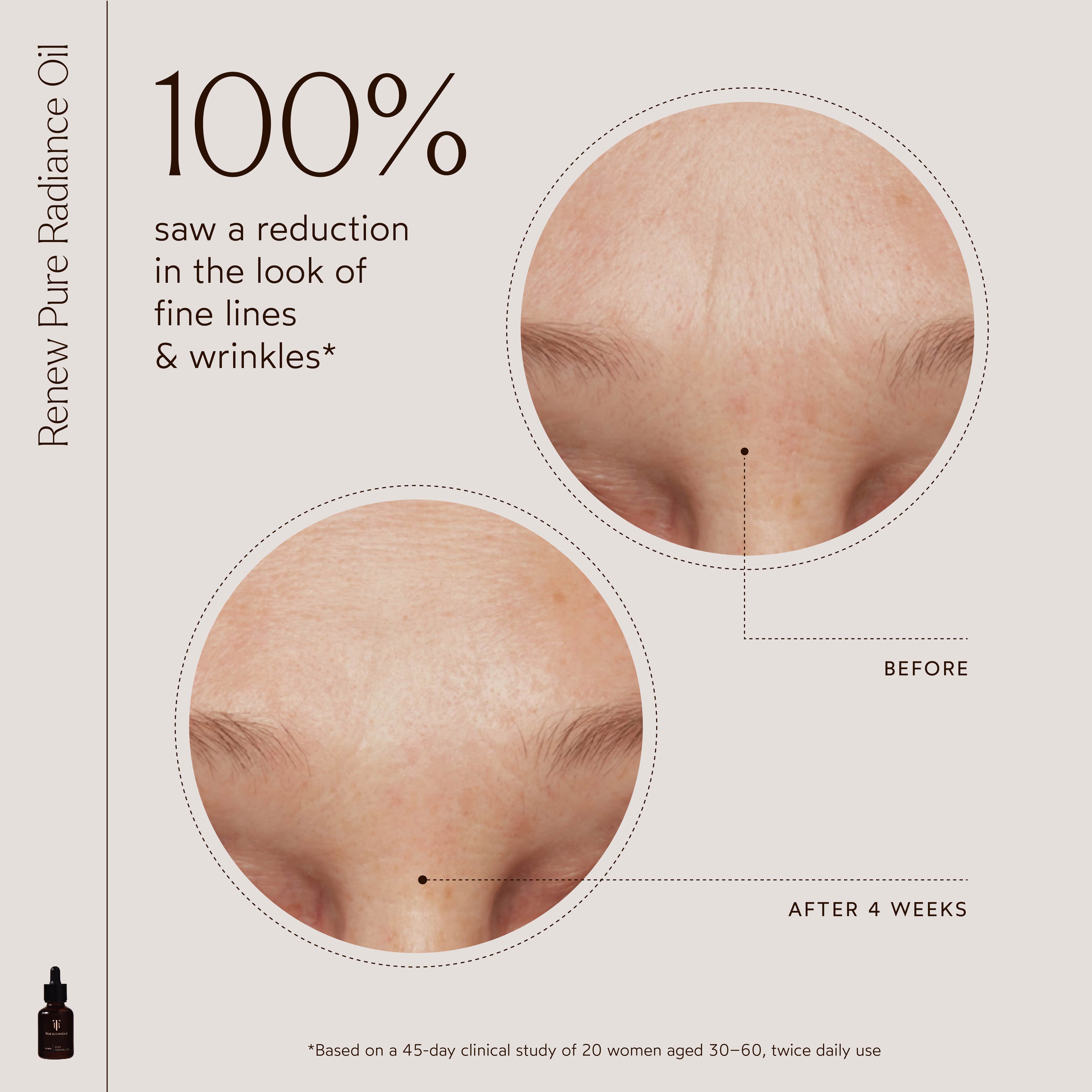 The Detox Market - Canada-Radiant Repair Night Ritual-RetailResizeBefore_Afters3-17_6f8d26f9-8785-4b61-a8a1-97eff08b5c95-The Detox Market | 