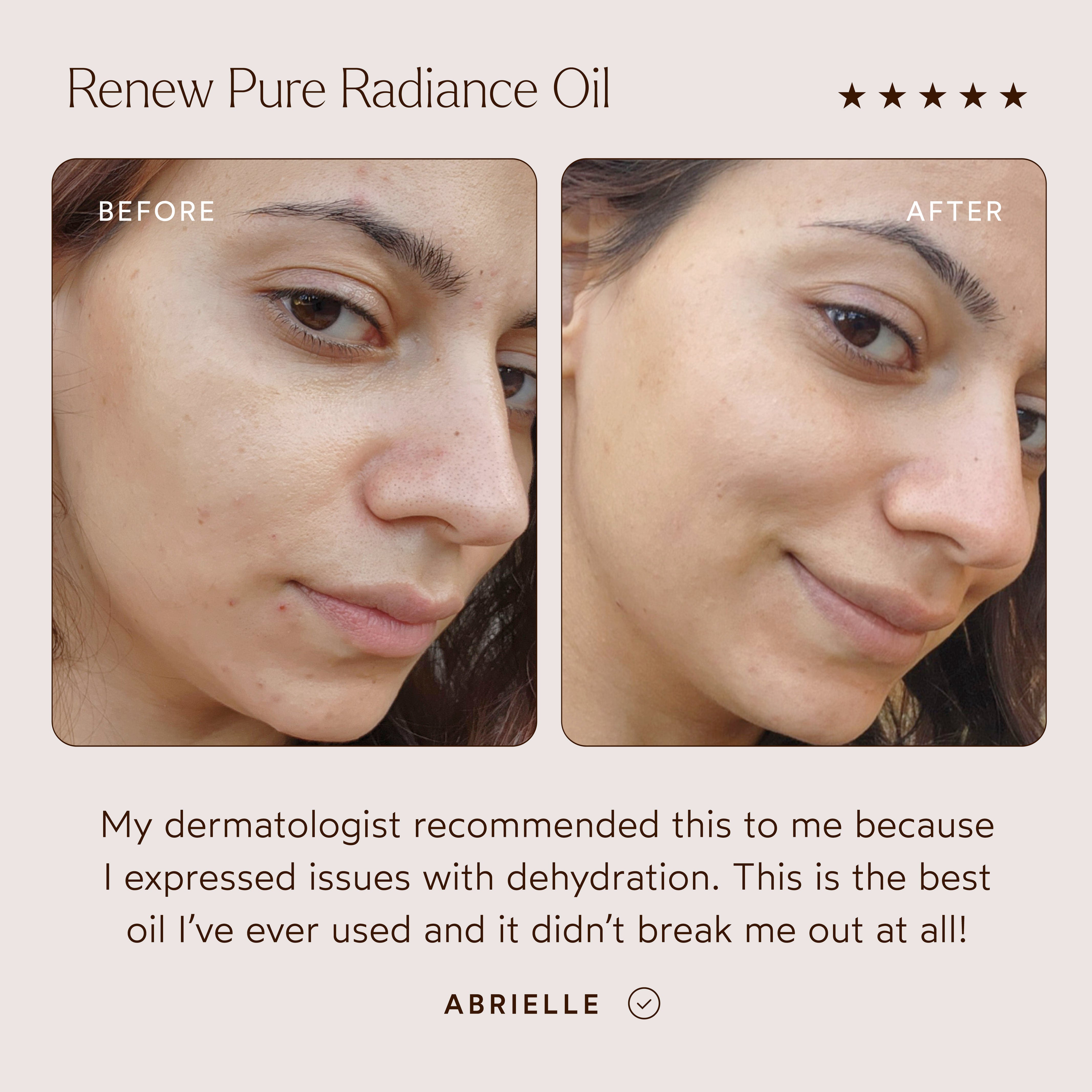 The Detox Market - Canada-Radiant Repair Night Ritual-RetailResizeBefore_Afters4-05_10e7f287-b13d-47e9-bc76-a148625df9e7-The Detox Market | 