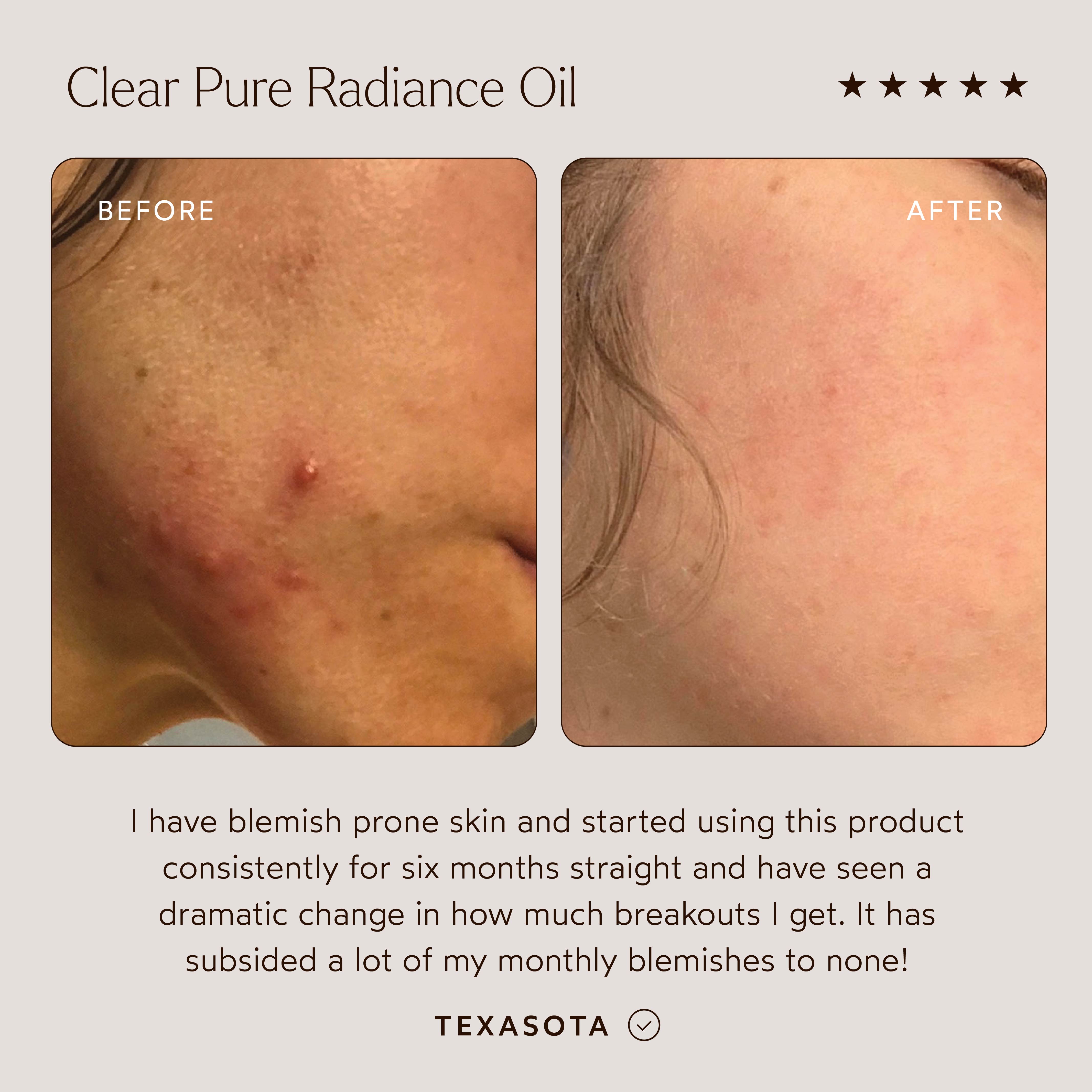 True Botanicals-CLEAR Pure Radiance Oil-Skincare-S-W-D-PRC1-R-3_9df1552a-876d-43dd-8d69-4017a83a6fdc-The Detox Market | 