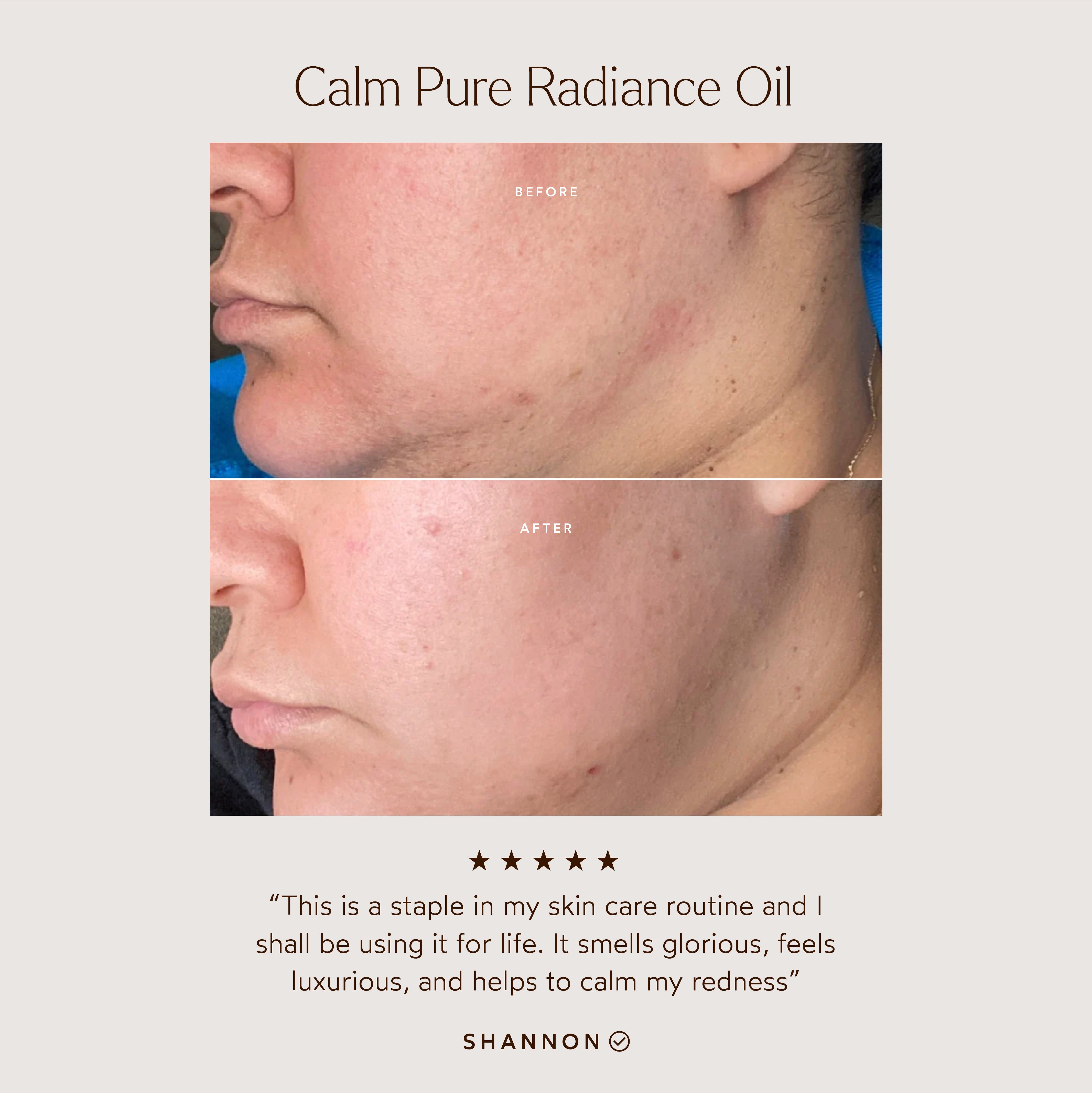 True Botanicals-CALM Pure Radiance Oil-Skincare-S-W-D-PRCM-R-3_81ec7a95-8395-484d-bdd0-1f888f467540-The Detox Market | 