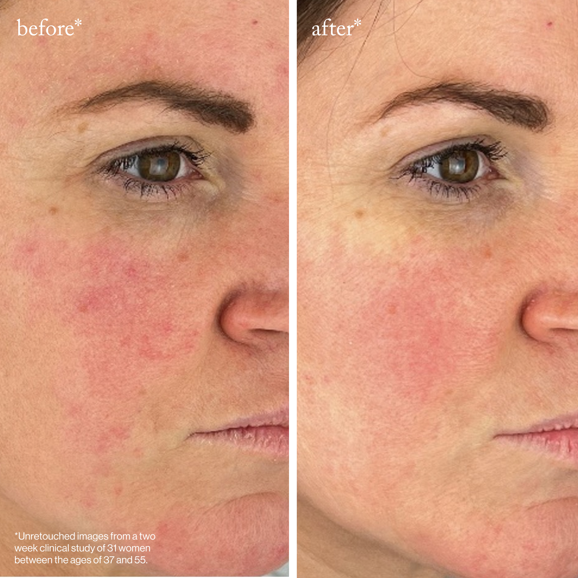 Goop-Youth-Boost Peptide Serum-Skincare-youthboostpeptideserum_imgCarousel_beforeandafter_438ff0bd-aa16-4305-babb-dbdcd3fa01ea-The Detox Market | 